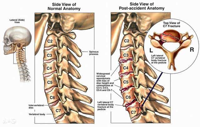 Cột sống cổ có công dụng bảo vệ tủy sống cùng hệ thống dây thần kinh và mạch máu (Ảnh: ifun01.com)